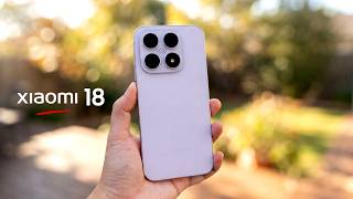 Xiaomi 18 - This is Actually Better?